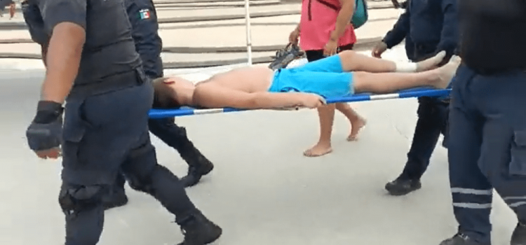 Mantarraya pica a un niño en el malecón de Progreso